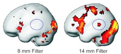 How clear is our view of brain activity?