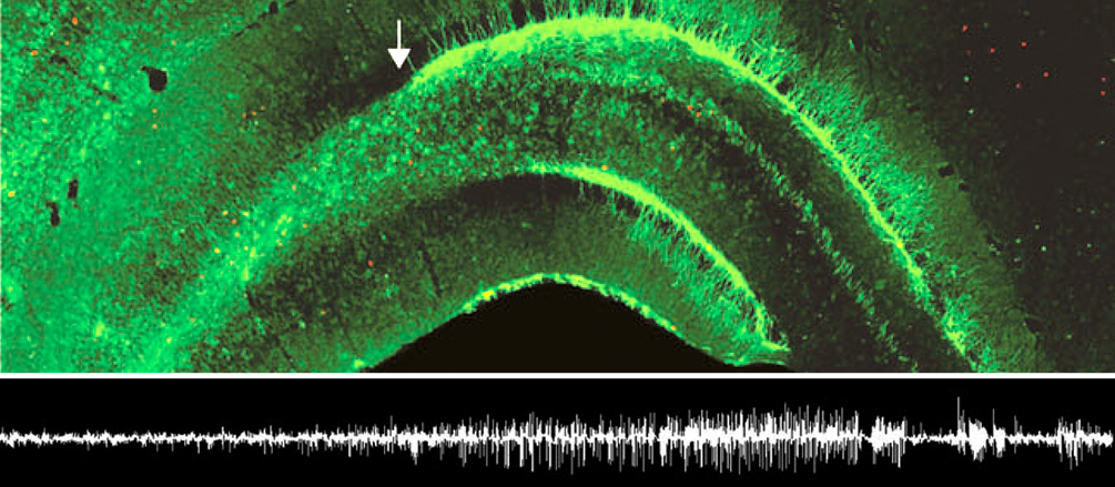 New article in “Cerebral Cortex”: Epileptic state stimulates genesis of nerve cells