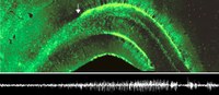 New article in “Cerebral Cortex”: Epileptic state stimulates genesis of nerve cells