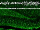 Neuroscientists from Freiburg show that glial cells protect the brain from epileptic seizures