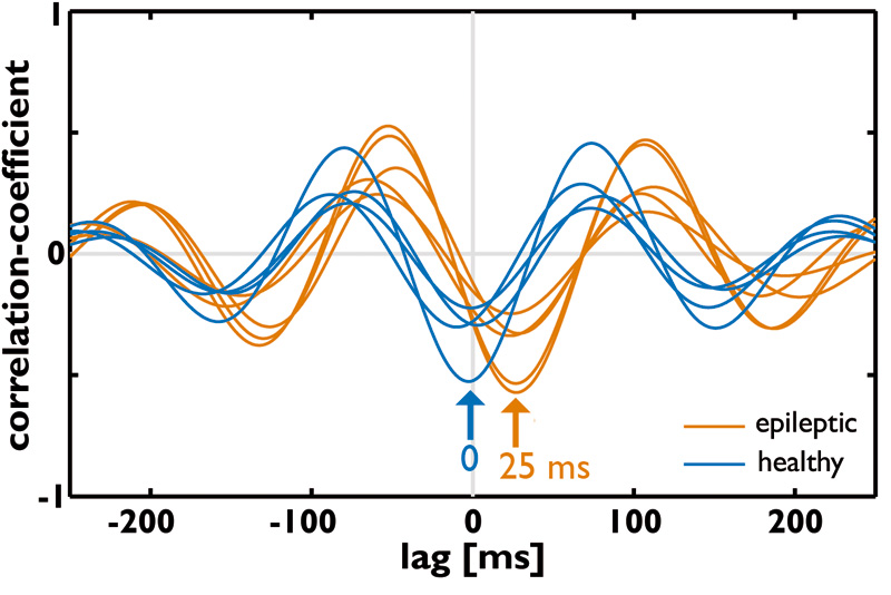 Epileptic signatures - outside of epileptic seizures