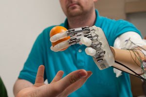 Prostheses with Sensory Feedback