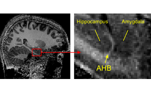 A Sharper View into the Brain