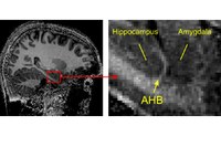 A Sharper View into the Brain