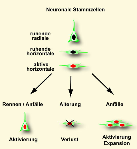 nervenzellen-alter.jpg