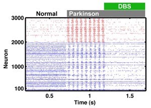 parkinson.jpg